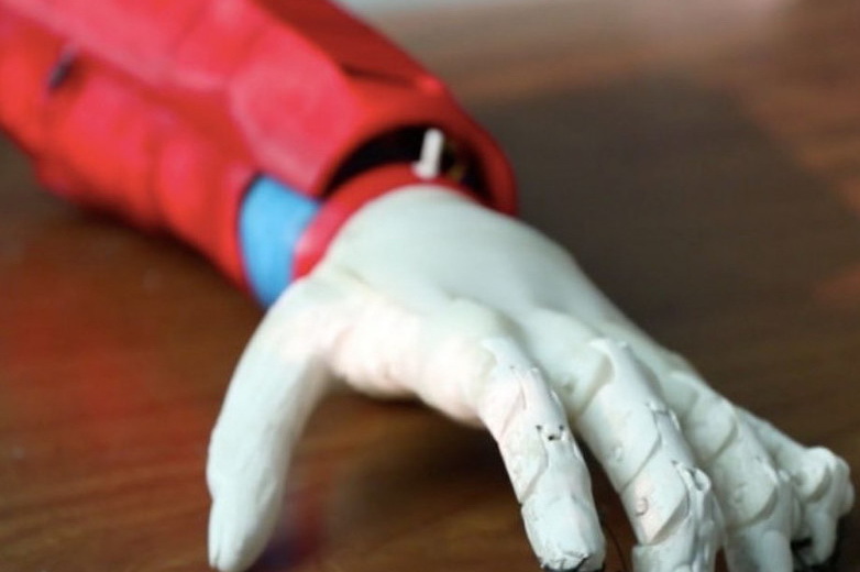 U Tunisu pomoću 3D printera izrađena bionička ruka na solarnu energiju